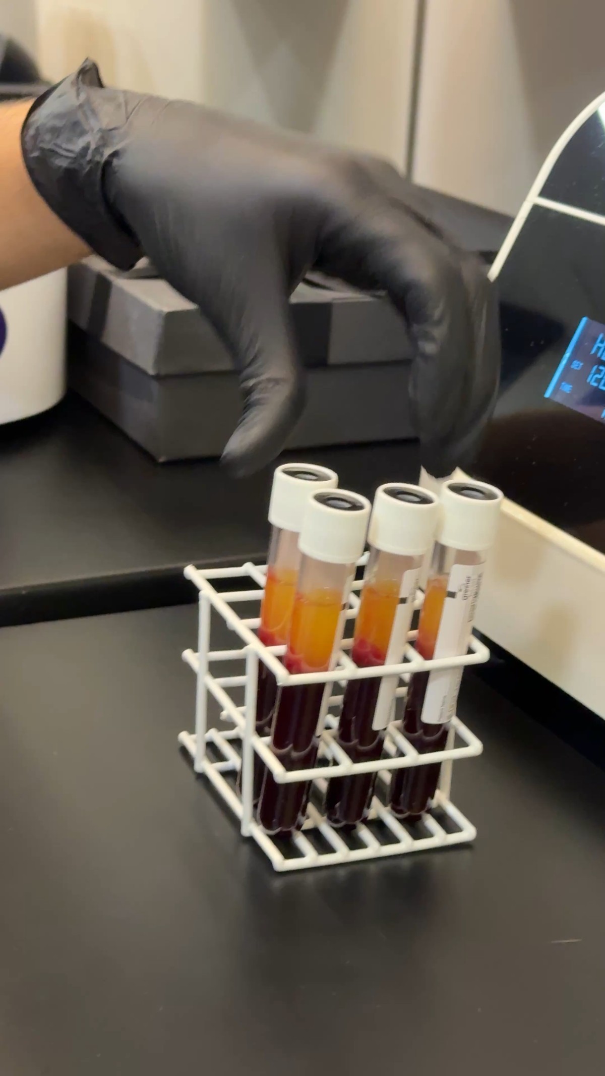 Rack com tubos de i-PRF centrifugados ao lado da centrífuga, mostrando a separação entre plasma dourado e hemácias. Clínica Dr. Gustavo Martins, Rio de Janeiro.