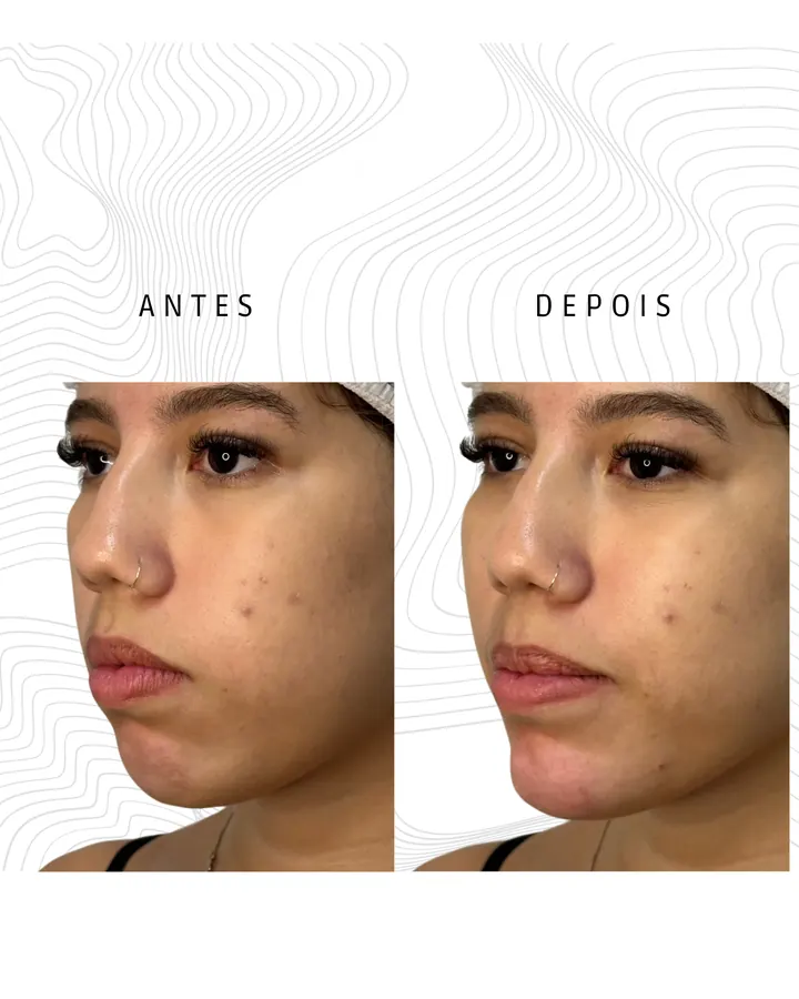 Método NaturalUp® — paciente 25