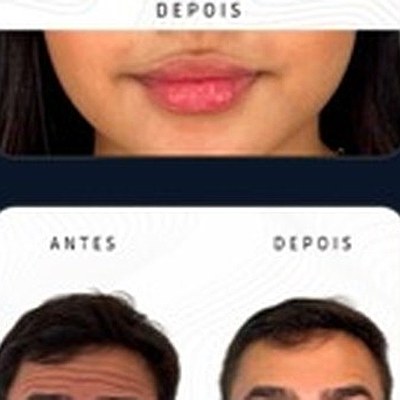 Resultado paciente 12