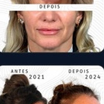 Resultado paciente 13