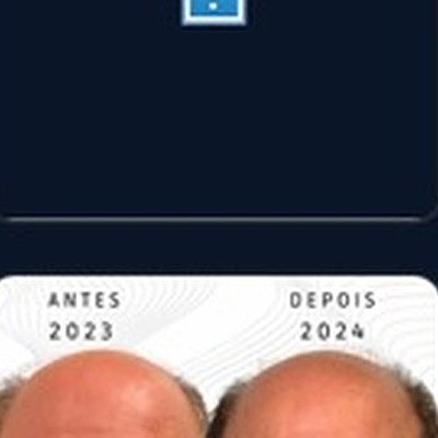 Resultado paciente 14