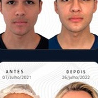 Resultado paciente 15