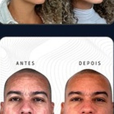 Resultado paciente 6