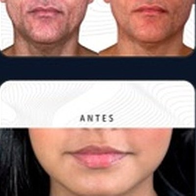 Resultado paciente 9