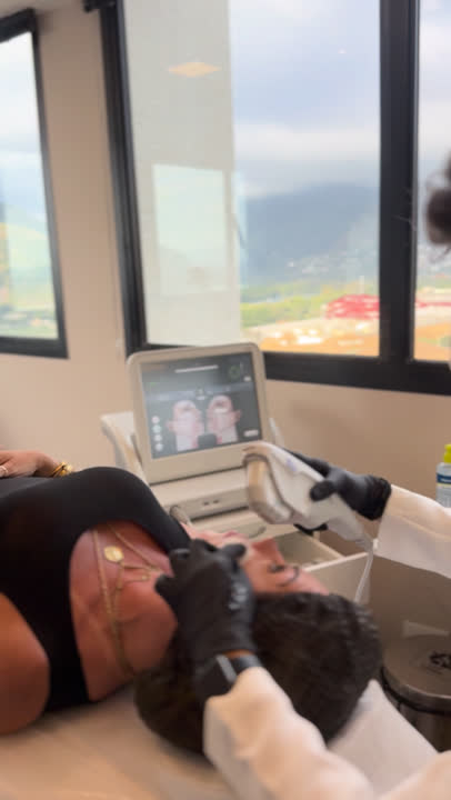 Aplicação do Ultherapy PRIME na Clínica Dr. Gustavo Martins